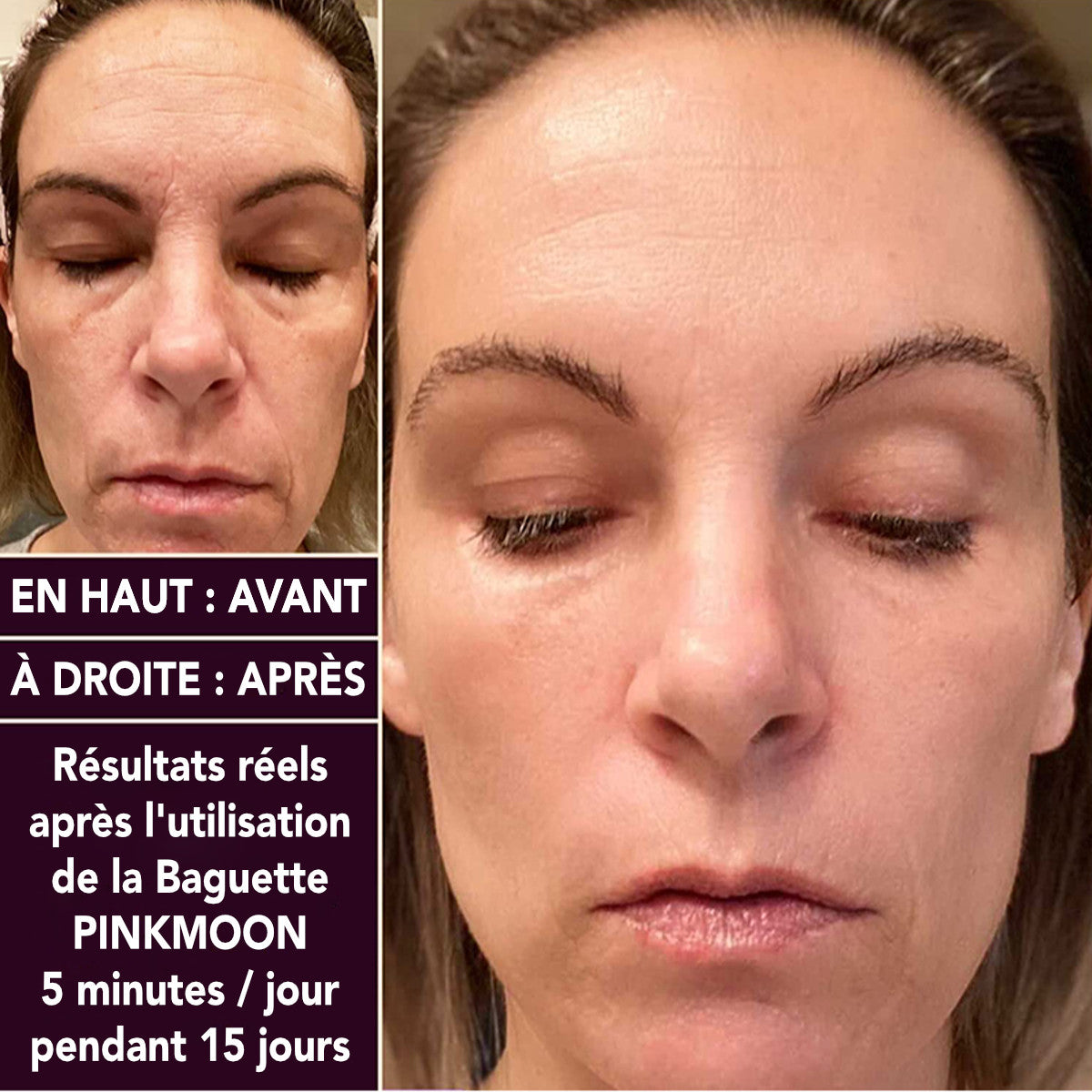 luminothérapie visage