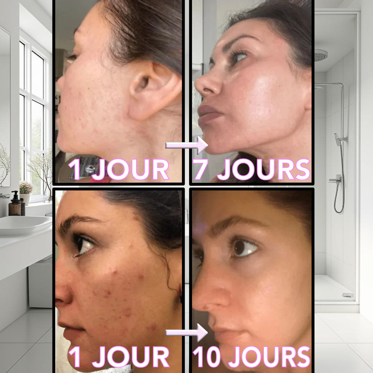 luminothérapie visage