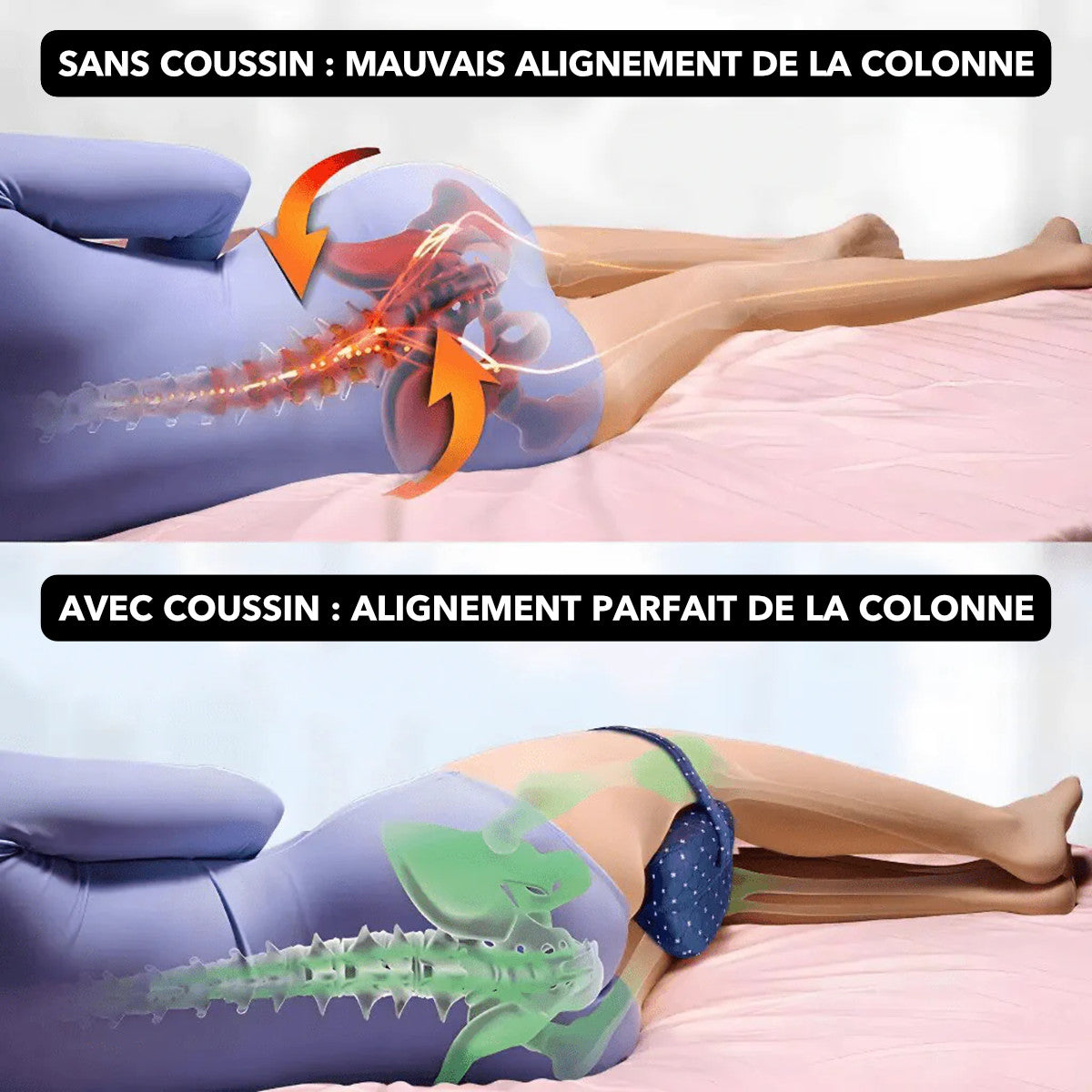Schéma montrant l'alignement correct des hanches et le soulagement du nerf sciatique grâce au coussin orthopédique