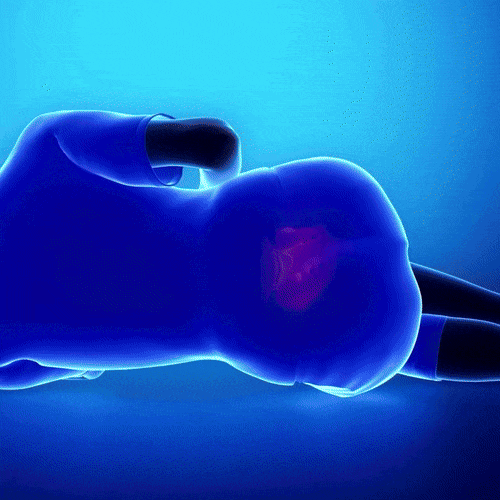 coussin de genoux orthopédique vidéo