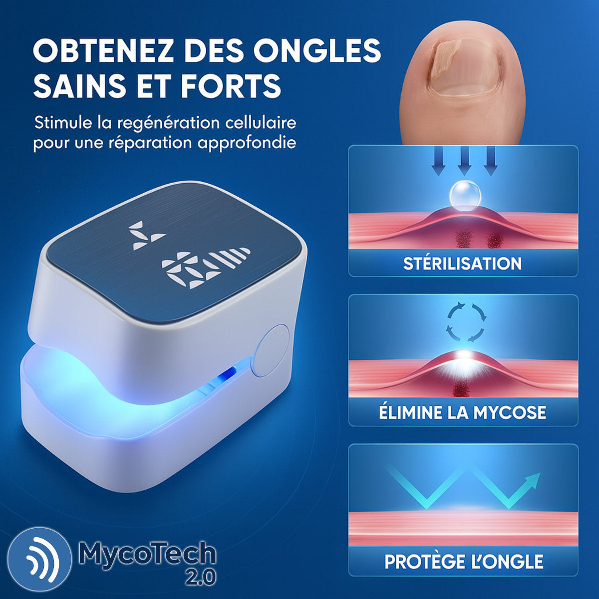 appareil mycose ongle