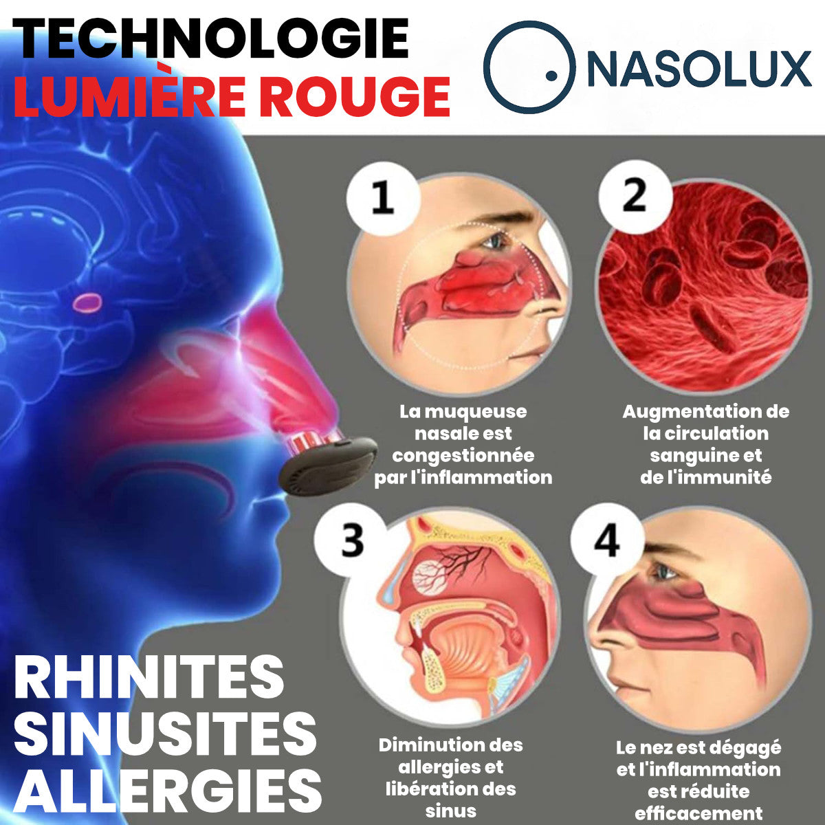 appareil rhinite et sinusite